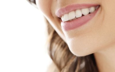 Blanqueamiento dental con láser. ¿Conoces sus ventajas?